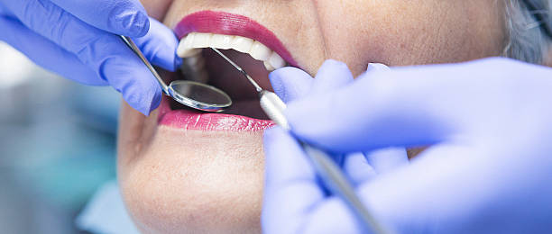 Best Emergency Dental Care for Broken or Chipped Teeth in Robert Lee, TX